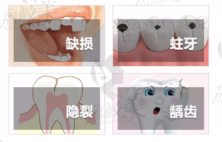 常見(jiàn)牙齒問(wèn)題
