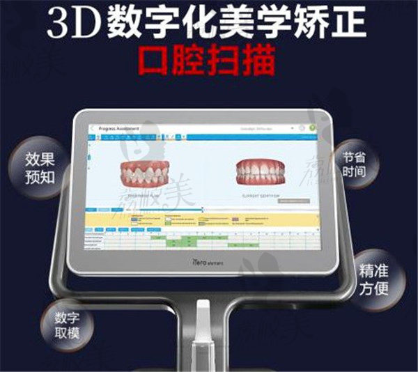 3D数字化牙齿矫正