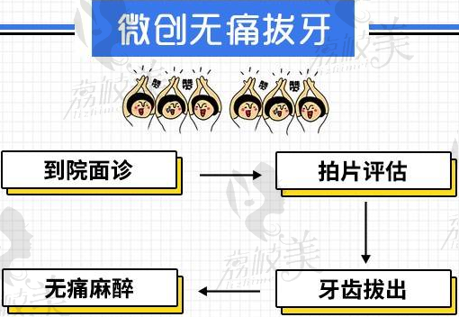 成都锦江极光口腔拔牙流程