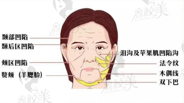 韩国清潭first成镇模院长小切口提升