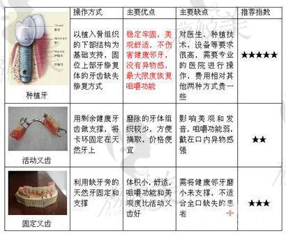 北京圣貝口腔牙齒修復(fù)三種方式對(duì)比