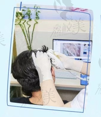 苏州圣爱植发中心毛囊检测