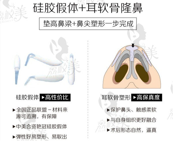 隆鼻材料