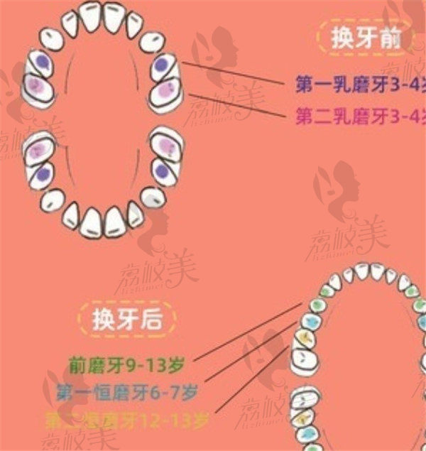 儿童蛀牙防护年龄