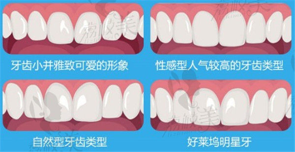 牙齒形狀