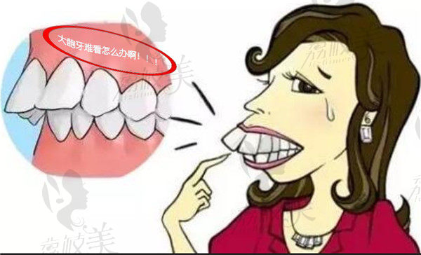大龅牙难看怎么办