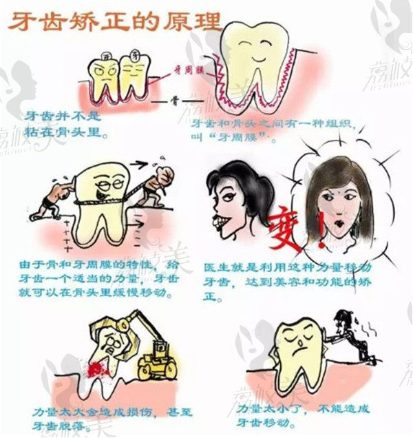 牙齿矫正原理