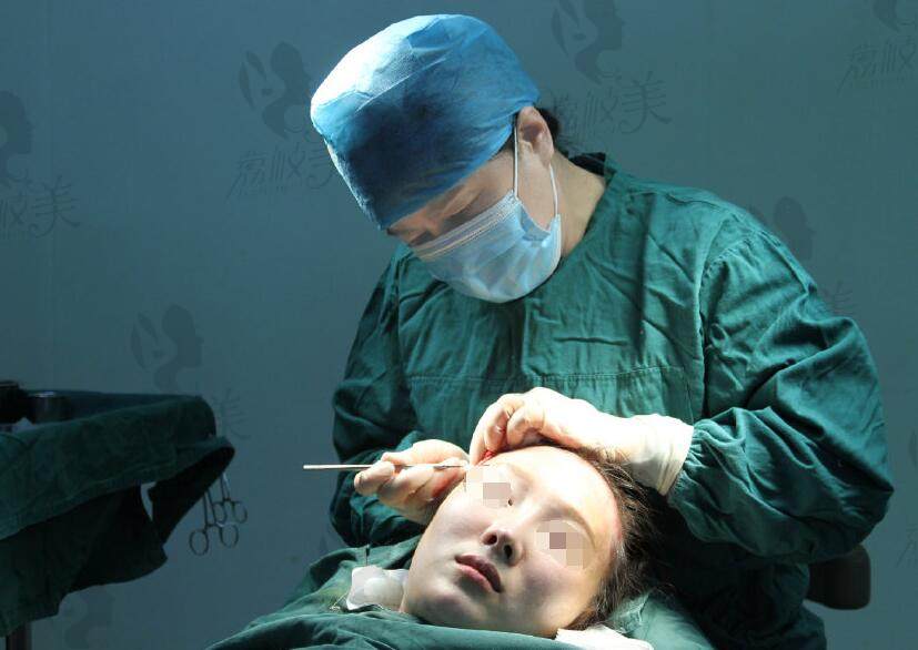 北京中德毛发移植医院徐霞院长在手术中