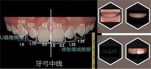 牙齒修復(fù)美學(xué)理念