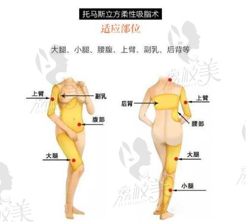 北京达美如意托马斯大腿吸脂,谷廷敏脂雕30年深度吸恢复快!