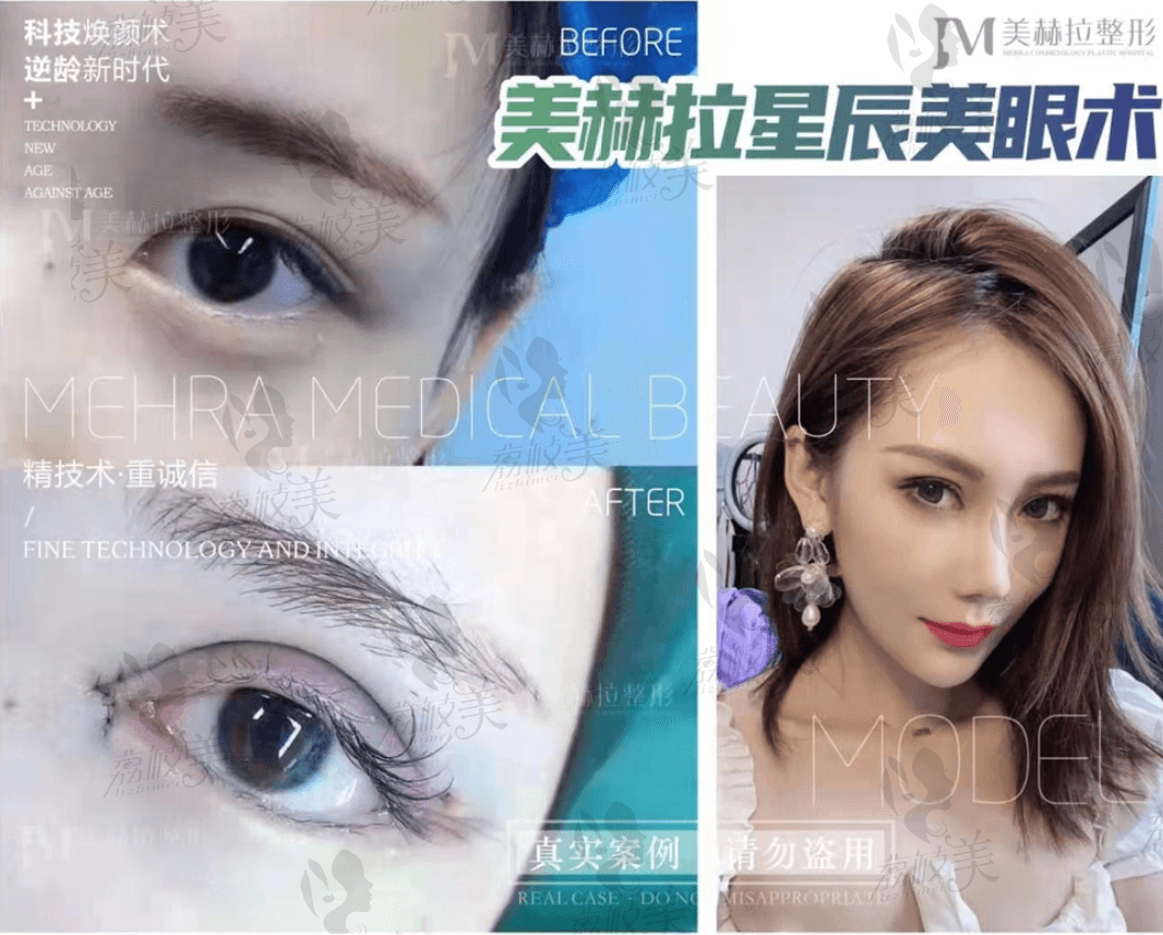 西安吉美赫拉美眼术<span style=
