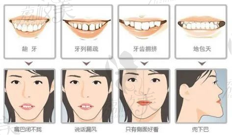 常见的几种牙齿问题