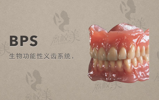 BPS生物功能义齿