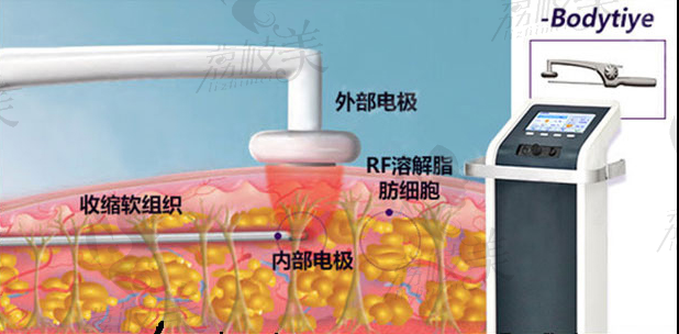 深圳容术方立院长的六维水柔体雕技术