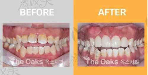 韩国橡树（the oaks）牙科医院案例