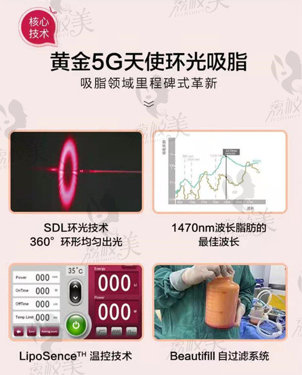 南京艺星医疗美容5G天使光环吸脂优势