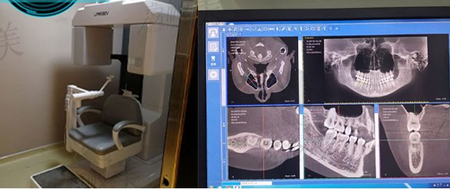 弘和口腔CBCT