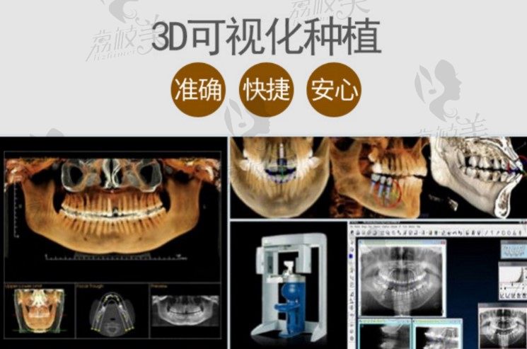爱思特3D可视化种植牙技术