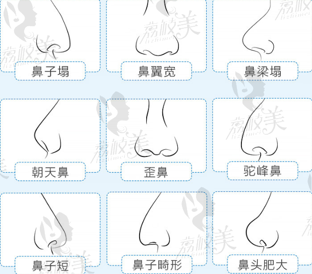 九大缺陷鼻