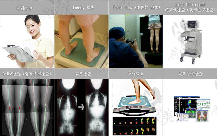 韩国JS美整形外科腿部矫正检查