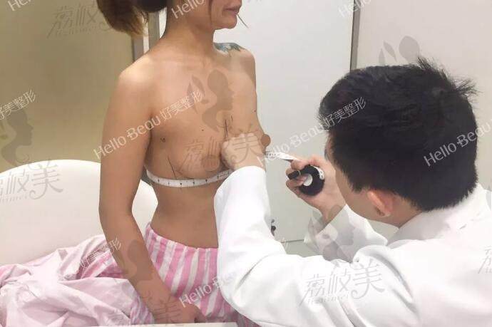 重庆好美刘正茂院长做美克拉美胸术前