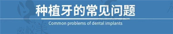 种植牙的常见问题
