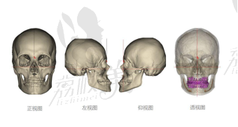 廣州廣大何錦泉----3d打印導(dǎo)板正頜技術(shù)