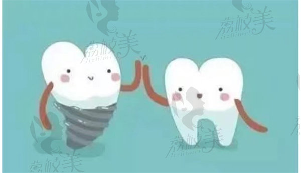 种植牙的修复过程