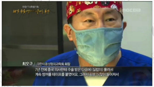 韩国环球整形外科医院代表院长崔午奎