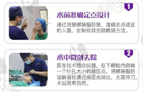 上海美诗沁院长宣瑞军MSQ激光去眼袋技术
