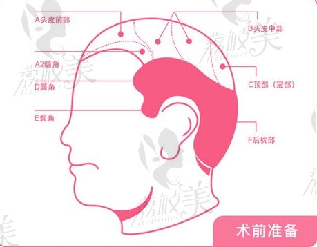 溫州原辰植發(fā)院長倪形斌