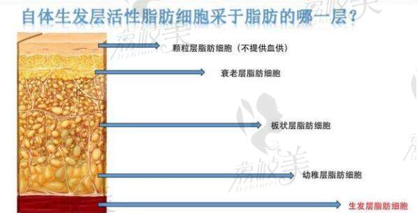 白晋博士CRT自体胶原蛋白再生技术