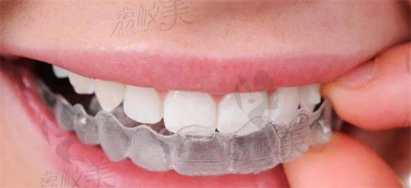 牙齿畸形对健康有危害?