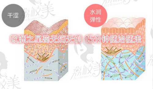 四、歐洲之星蕊媤縮陰術(shù)有副作用嗎？