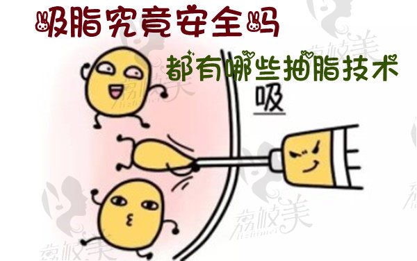 吸脂安全吗？抽脂技术有哪些