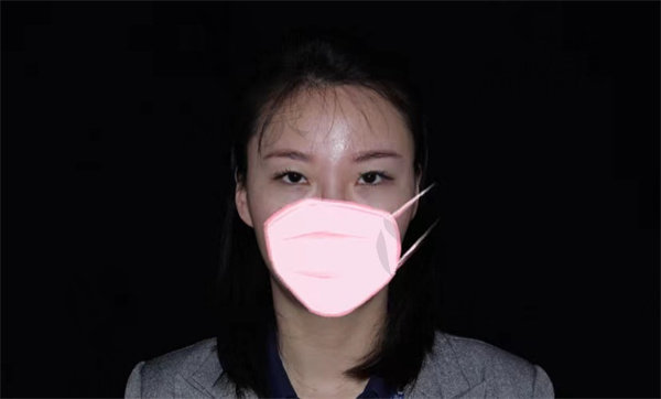 苏州康美张悦迪医师的灵动美眼综