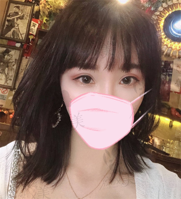苏州康美张悦迪医师的灵动美眼综