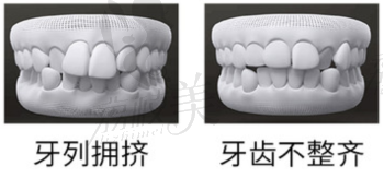 牙齿存在问题示意图