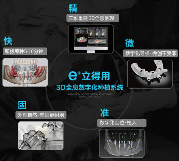 e+立得用数字化一站式舒适种植牙系统