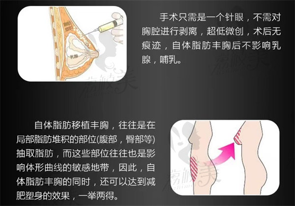 自体脂肪隆胸适合人群特征