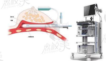 北京艺星赵志伟院长内窥镜仪器