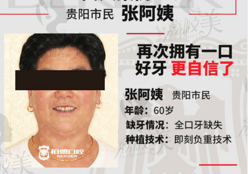 贵阳柏德口腔李春林种植牙病例