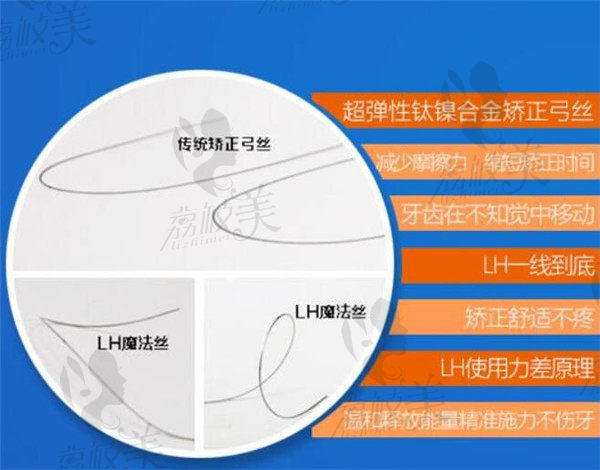 LH魔線超記憶矯正技術(shù)特點