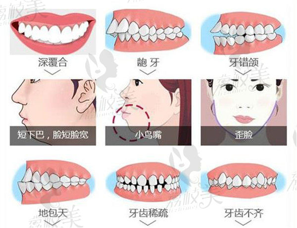 LH魔線超記憶矯正技術(shù)可解決的口腔問題