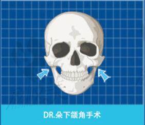 韩国DR.朵下颌角手术
