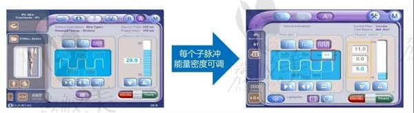 广州宸山Aopt超光子肌升级版