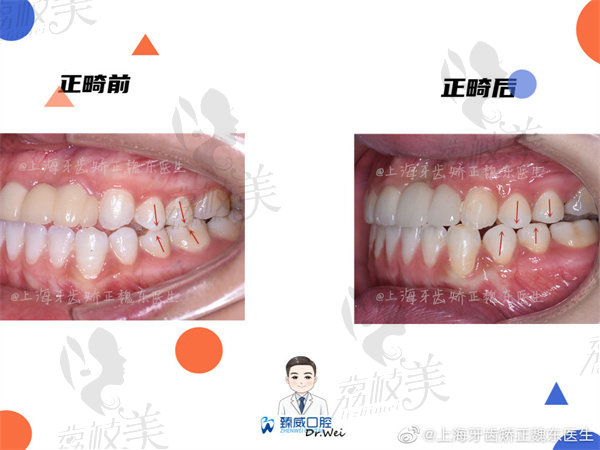 常州魏东口腔魏东医师口腔矫正