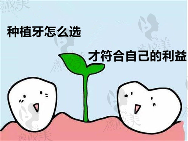 种植牙怎么选择才好