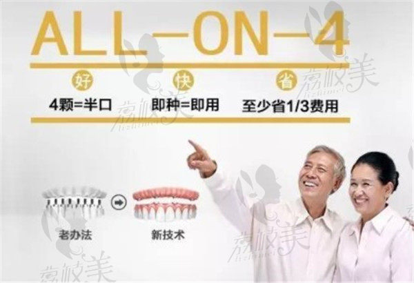 半口种植All on 4优势