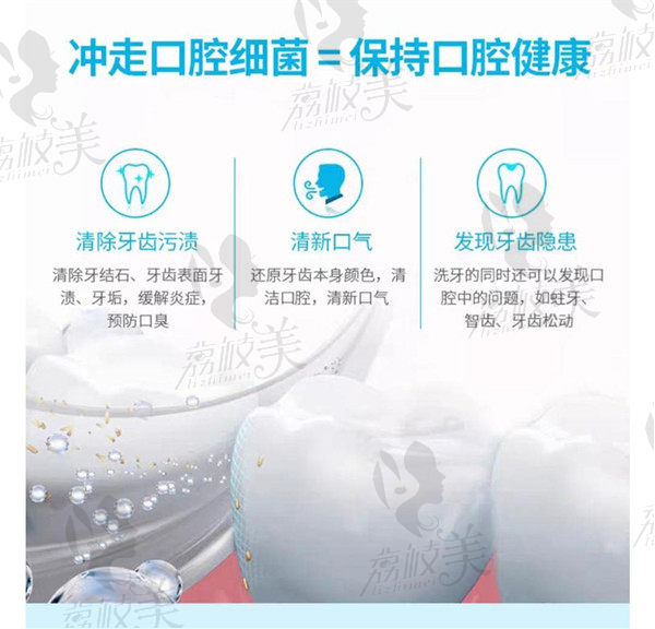 洗牙能预防牙周炎等口腔疾病